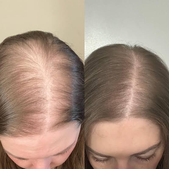 Customer photo